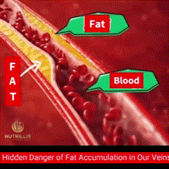 Fatty Vein square